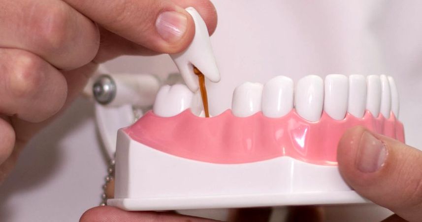 Протезирование зубов - зубные протезы